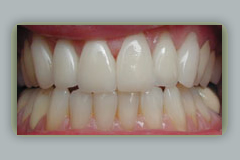 pictures periodontal disease image-2, pictures periodontal disease