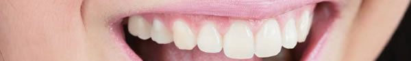 cosmetic dentures A client of Lake Forest Dental with beautiful teeth smiling to show off her cosmetic dentures