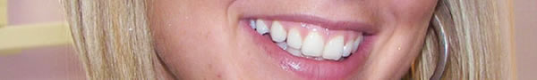 healthy smile with whitened teeth healthy smile with whitened teeth