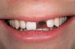 Dental Implant Specialists Orange County Dental Implant